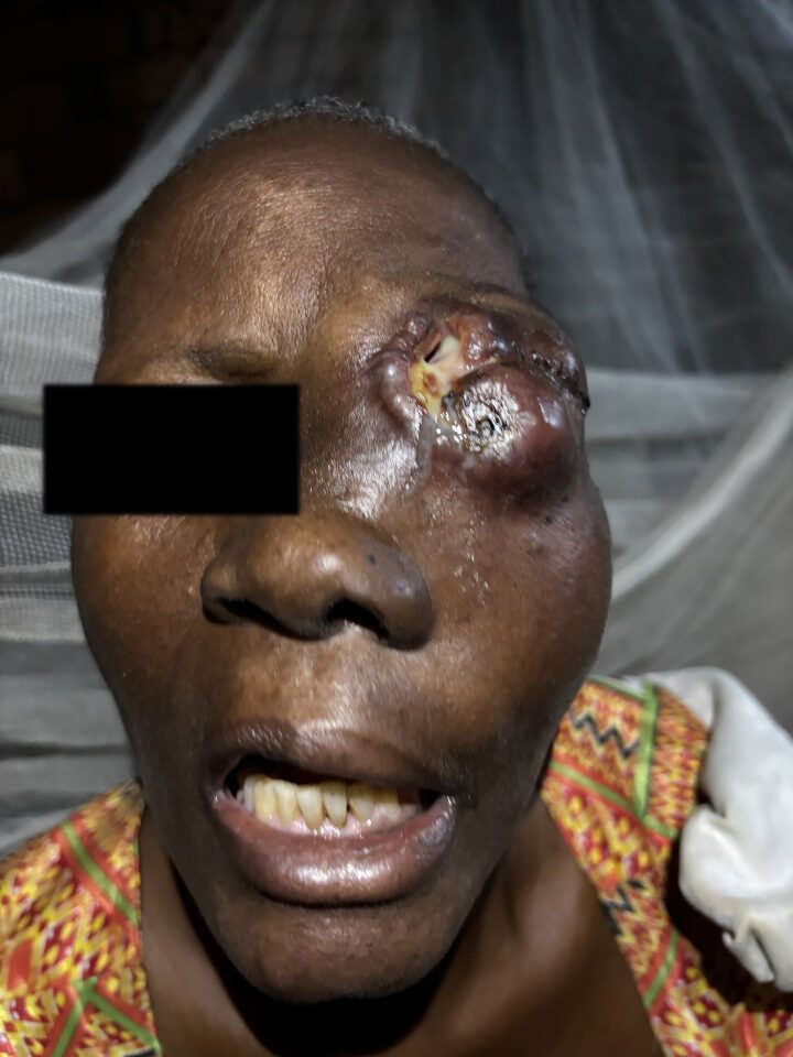 ”Vi mødte mennesker med sygehistorier, vi nok aldrig glemmer.”